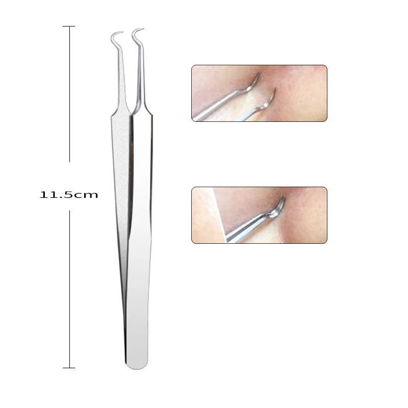 Blackhead Removal Needles