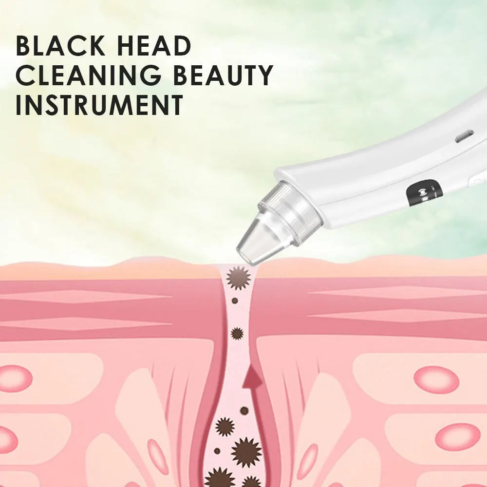 Vacuum blackhead remover tool