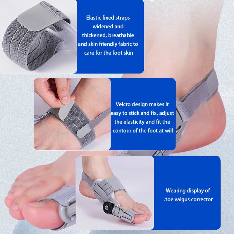 Foot Hallux Valgus  Finger Corrector